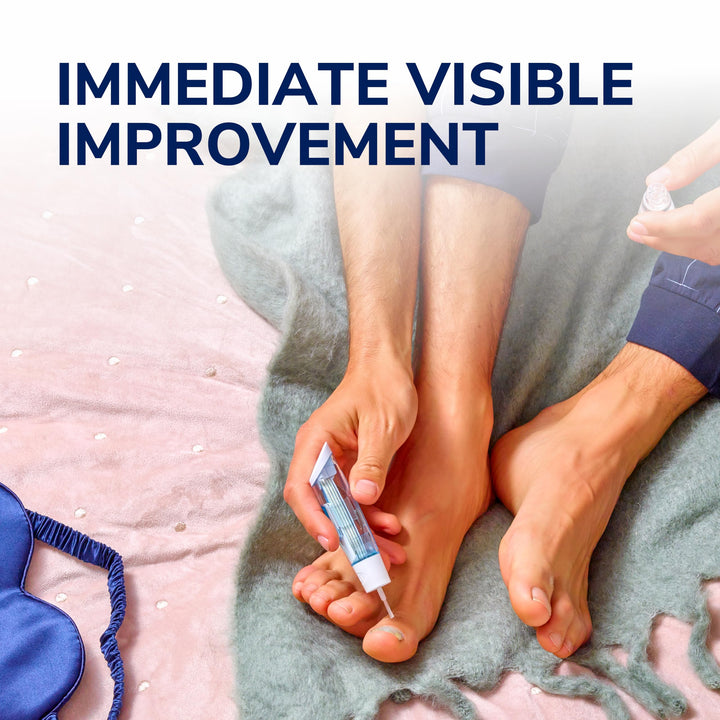 Scholl anti-fungal nail treatment kit with file and brush applicator for targeted care